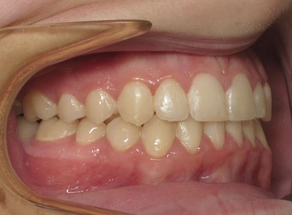 Karis: Karis - After