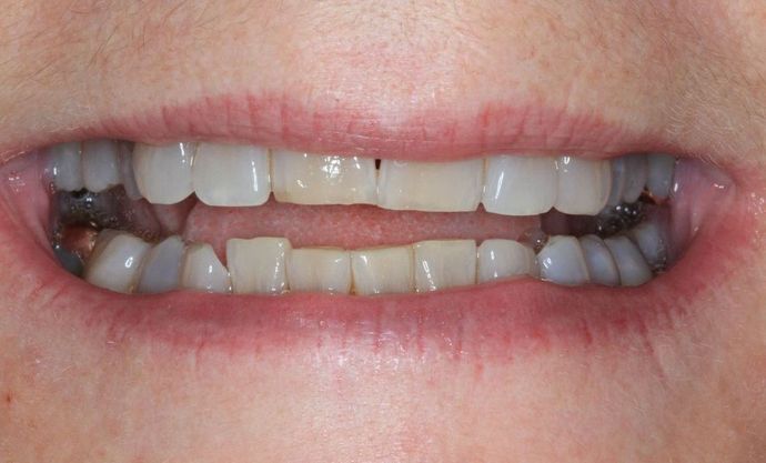 Kor Whitening Case 8 - Before