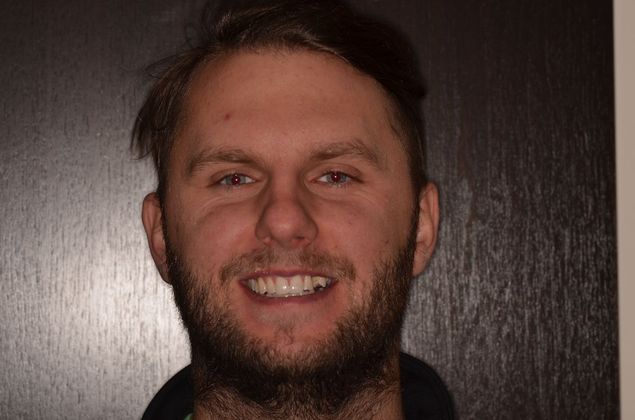 Porcelain Veneers: Case 26 - Before veneers and implant