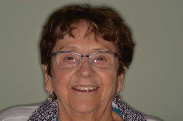 Bridges: Case 9 - After implant supported bridge