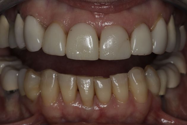 Cosmetic Dentistry Cosmetic Dentistry - Case 8 - Before