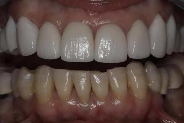 Cosmetic Dentistry Cosmetic Dentistry - Case 8 - After