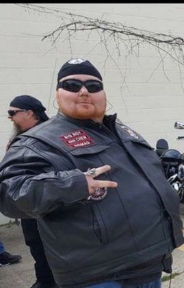 Before Bariatric Surgery