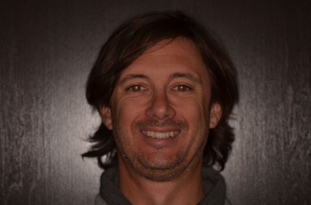 Invisalign: Case 17 - Before smile 