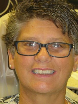 Dental Crowns Case 30 - Before