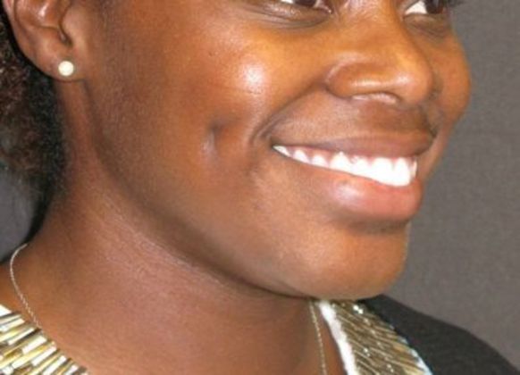 Dimple creation: Case 1 - After