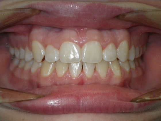 Orthodontics: Case 31 - After