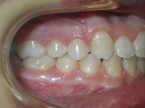 Orthodontics: Case 31 - After