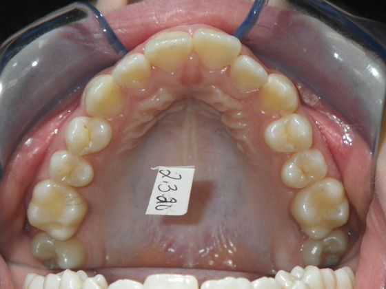 Orthodontics: Case 31 - Before