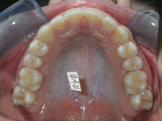 Orthodontics: Case 31 - After