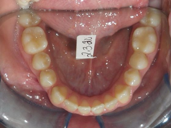 Orthodontics: Case 31 - Before