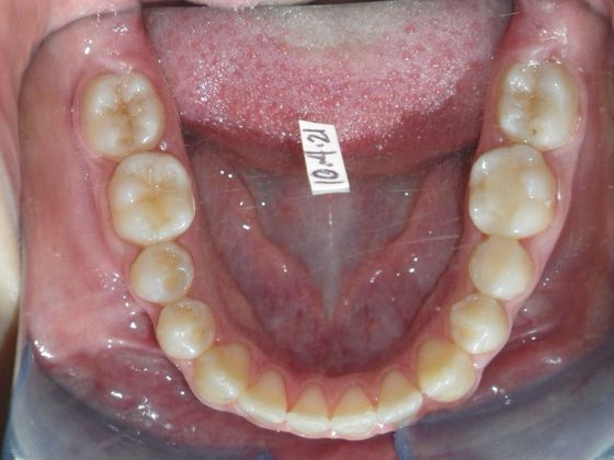 Orthodontics: Case 31 - After