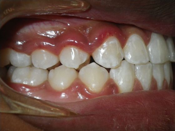 Orthodontics: Case 32 - After