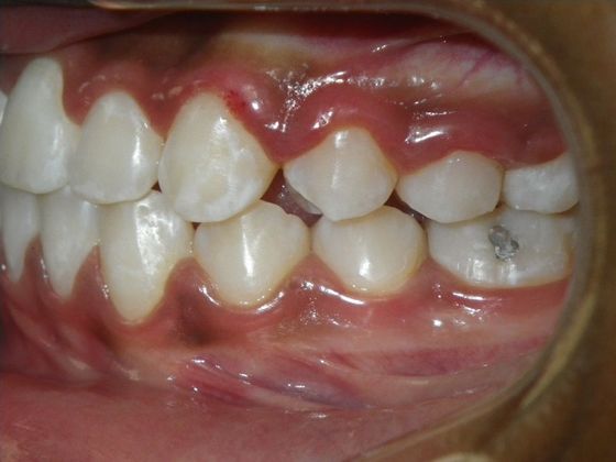 Orthodontics: Case 32 - After