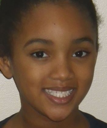 Orthodontics: Case 32 - Before