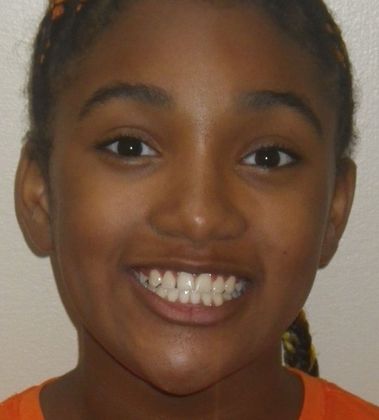 Orthodontics: Case 32 - After