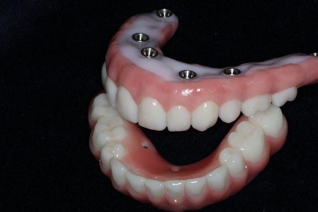 Teeth In A Day Case 23 - Before