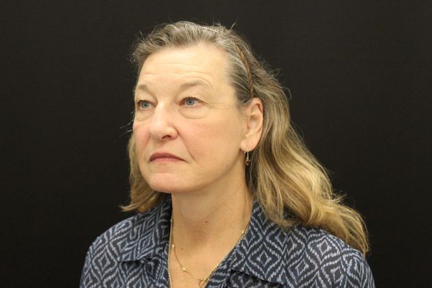 Face & Neck Lifts Case 8 - After