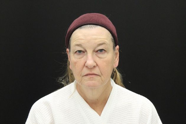 Face & Neck Lifts: Case 8 - Before