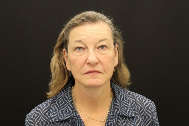 Face & Neck Lifts: Case 8 - After