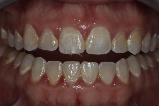 Cosmetic Dentistry: Cosmetic Dentistry - Case 9 - Before