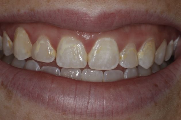 Cosmetic Dentistry Cosmetic Dentistry - Case 9 - Before