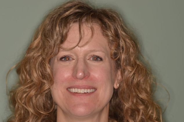 Invisalign: Case 19 - Before invisalign with overlapping front teeth