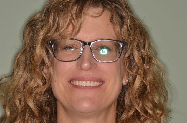 Invisalign: Case 19 - After invisalign (orthodontics)