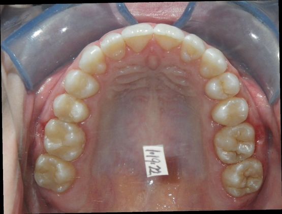Orthodontics: Case 33 - After