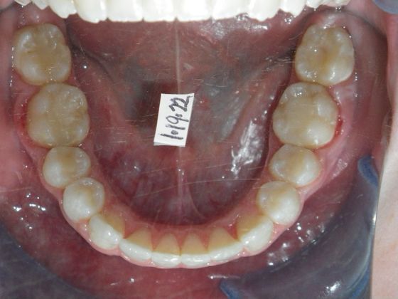 Orthodontics: Case 33 - After