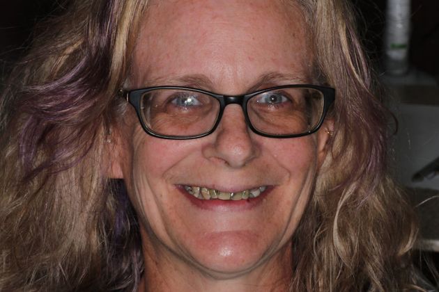 Dentures: Case 7 - Before