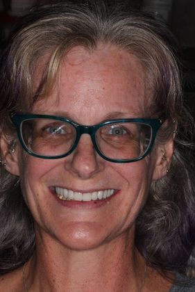 Dentures: Case 7 - After