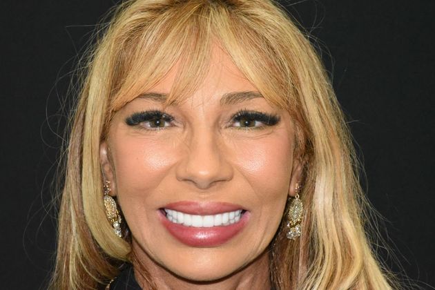 All on 4 (Full Arch Implant Cases) Case 9: Upper and Lower All on 4 - After