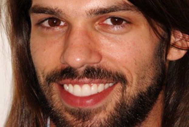 Veneers: Steve H. - After