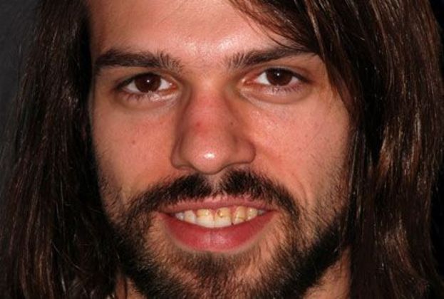 Veneers: Steve H. - Before