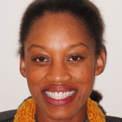 Veneers: Rahisha B. - After