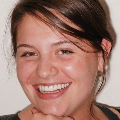 Cosmetic Bonding Career Ready - After