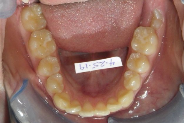 Orthodontics: Case 34 - After