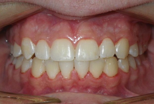 Orthodontics: Case 34 - After