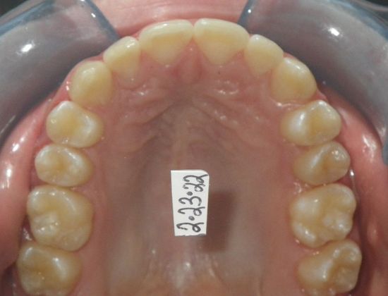 Orthodontics: Case 34 - After