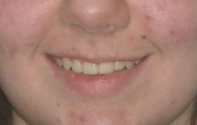 Orthodontics: Case 34 - After