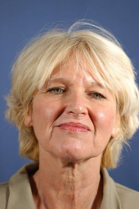 Facelift: Browlift and facelift - Before anything 54 yo