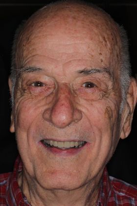 Dentures Case 8 - After