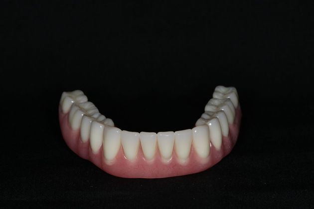 Dentures: Case 9 - Lower Denture