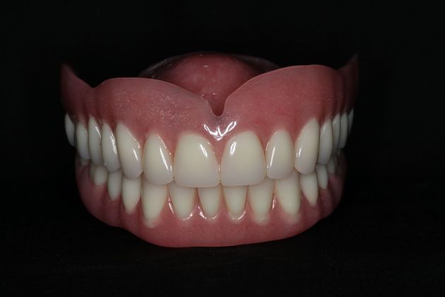 Dentures: Case 9 - Upper and Lower Denture
