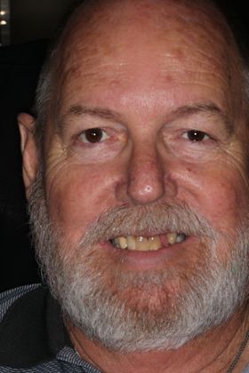 Dental Implants Case 8 - Before