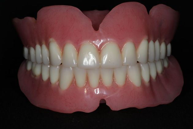 Dentures: Case 10 - Final Dentures