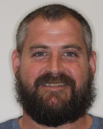 Full Mouth Reconstruction Case 7 - Before