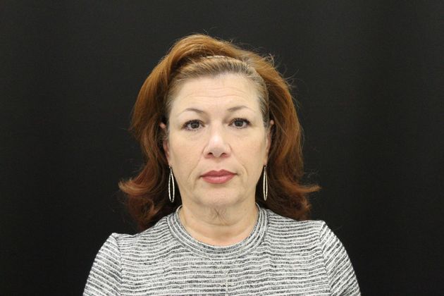 Face & Neck Lifts: Case 6 - Before