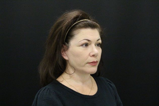 Face & Neck Lifts: Case 6 - After